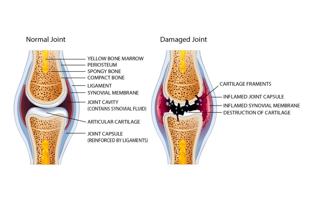 Calibra-VD-web-pict-joint